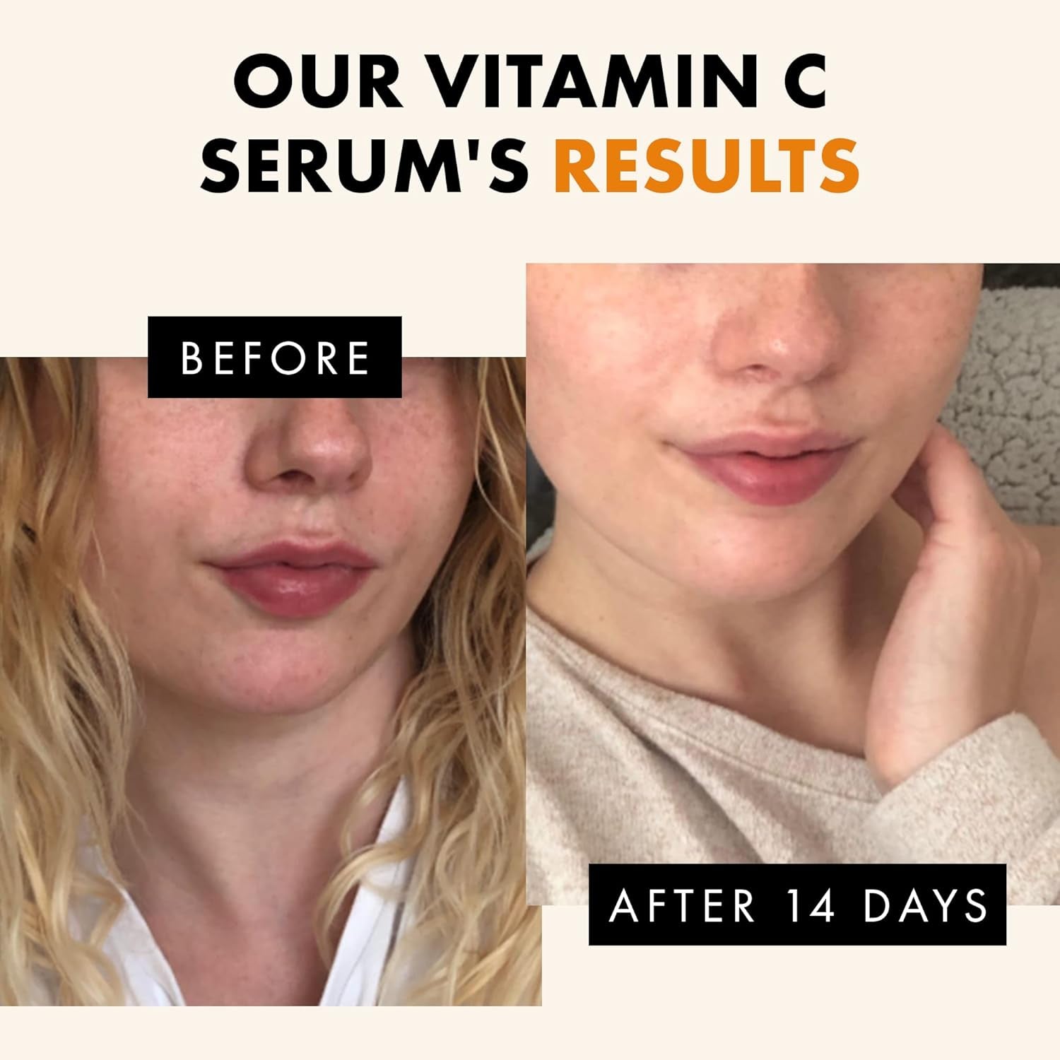 Vitamin C Face Serum - Dark Spot Remover Facial Serum, Vit C Serum with Hyaluronic Acid, Ferulic Acid, & Vit E - Anti Aging and Skin Brightening Serum, Pure Vitamin C Serum Skin Care 30 ml